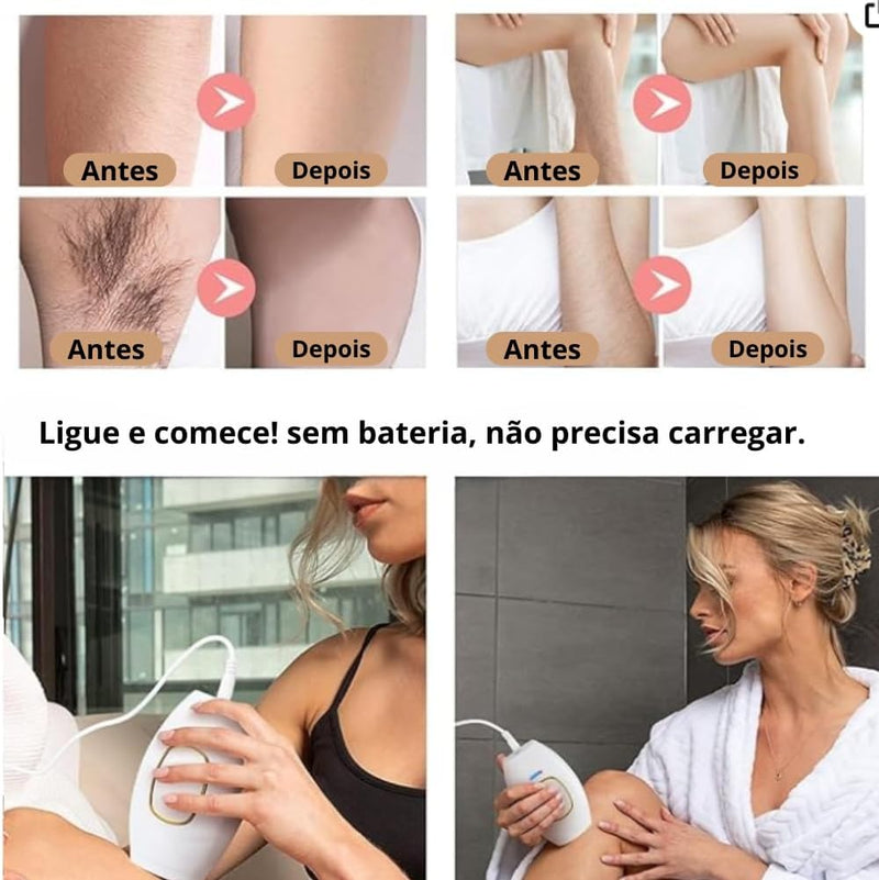 Depilador à Laser Portátil Permanente e Indolor - HairRemover - Elimine os Pelos Definitivamente